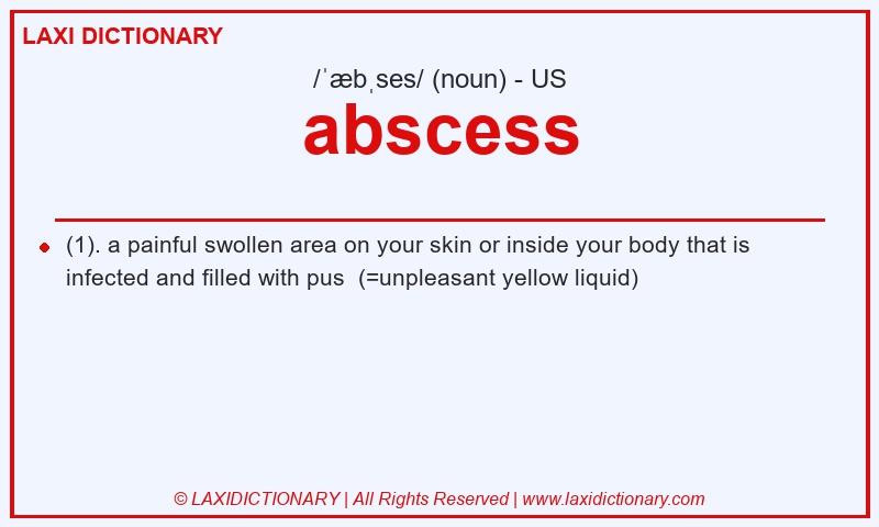 Definition abscess in American English