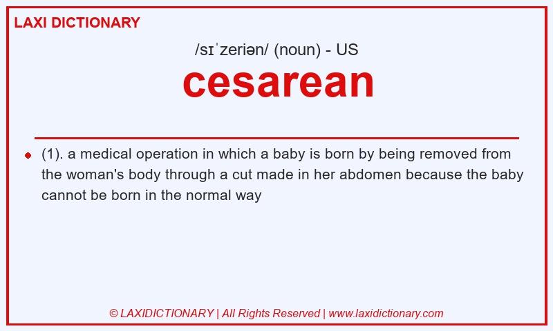 Definition cesarean in American English