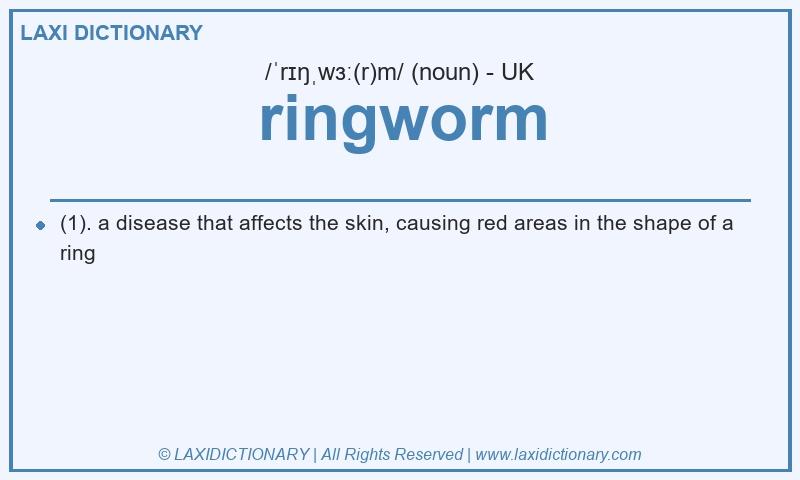 Definition ringworm in British English